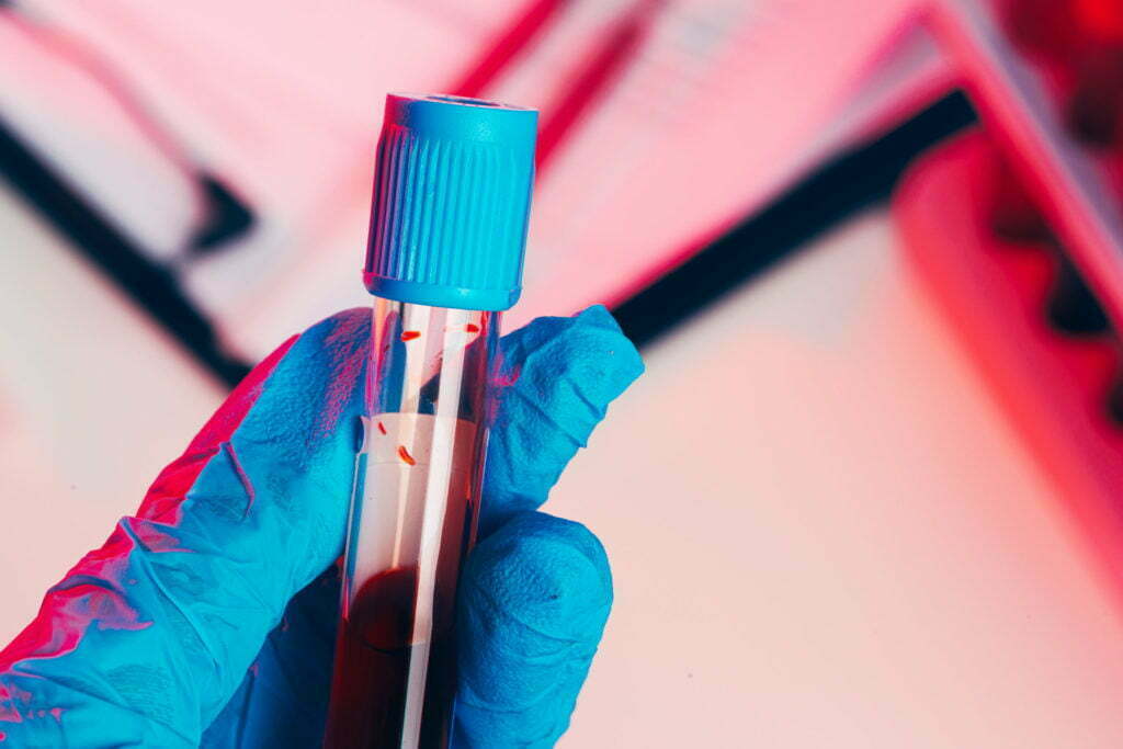 hands in blue gloves keep test tube with a blood